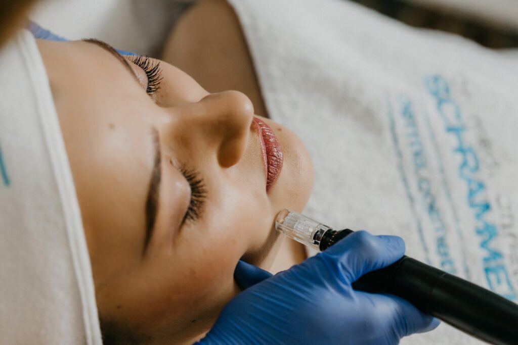 Beneficios de Hydrafacial