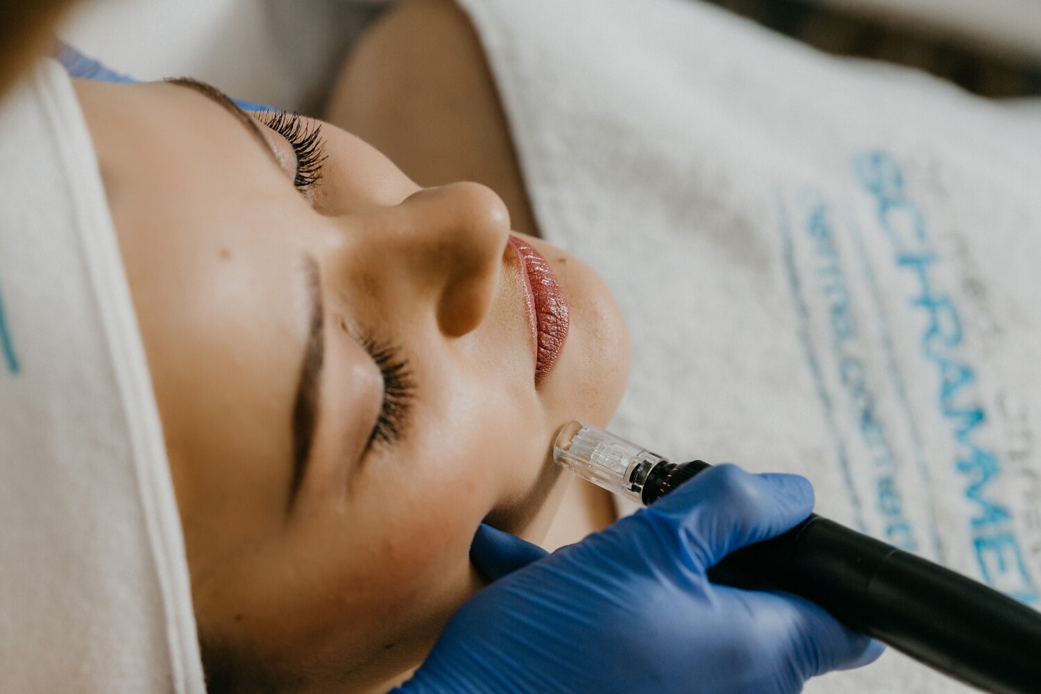 Beneficios de Hydrafacial